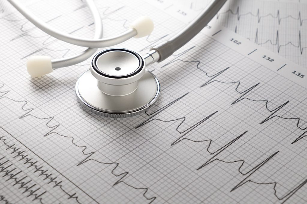 Cardiologista em Santa Maria esclarece dúvidas sobre arritmia cardíaca, palpitações e coração acelerado.